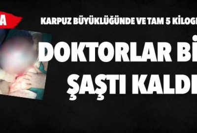 Doktorlar bile şaştı kaldı