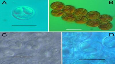 Türk bilim insanları 4 yeni parazit türü keşfetti
