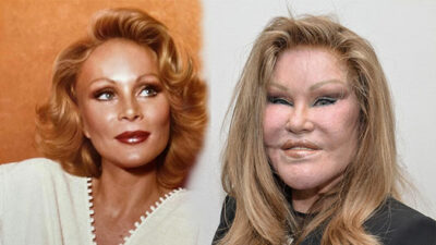 Estetik bağımlılıyla tanınan “Kedi Kadın” Jocelyn Wildenstein yaşamını yitirdi